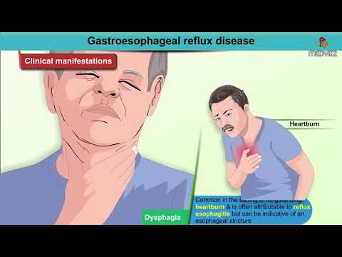 Fogyás terve Gerd számára - Speciális étrend GERD vagy Gastroesophagealis Reflux betegség esetén