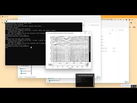 Parkinson Detection using EEG Dataset in Python Projects