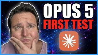 Claude Opus 5 Is INSANE – Is This the BEST Model Yet?