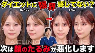 【顔の肉を落とす方法】ダイエットだけでは限界。脂肪吸引と糸リフトの相乗効果をお見せします