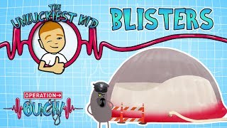 Science for kids | BLISTERS | Experiments for kids | Operation Ouch