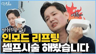 인모드 리프팅 셀프시술 해봤습니다 (feat. 마취크림 꼭 바르세요)