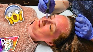 What Did They Do TO MY FACE!? 😱