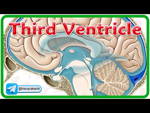 Third Ventricle Anatomy Animation ( Location, Recesses, Communications & Boundaries ) / Neuroanatomy