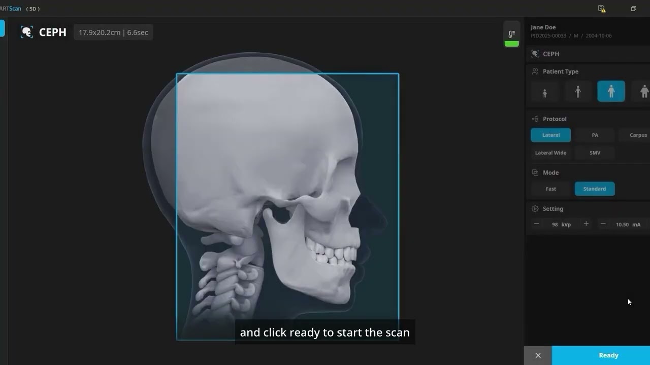 Cephalometric Post Capture & File Save
