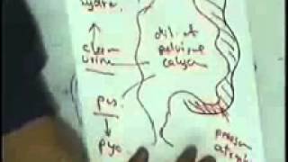 renal stones & hydronephrosis : DR SAMEH GHAZY