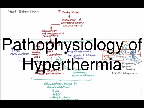 Hyperthermia Pathophysiology