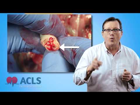 Neonatal Resuscitation Algorithm