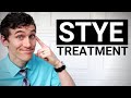 How to Treat a Stye - Eye Stye Home Remedies