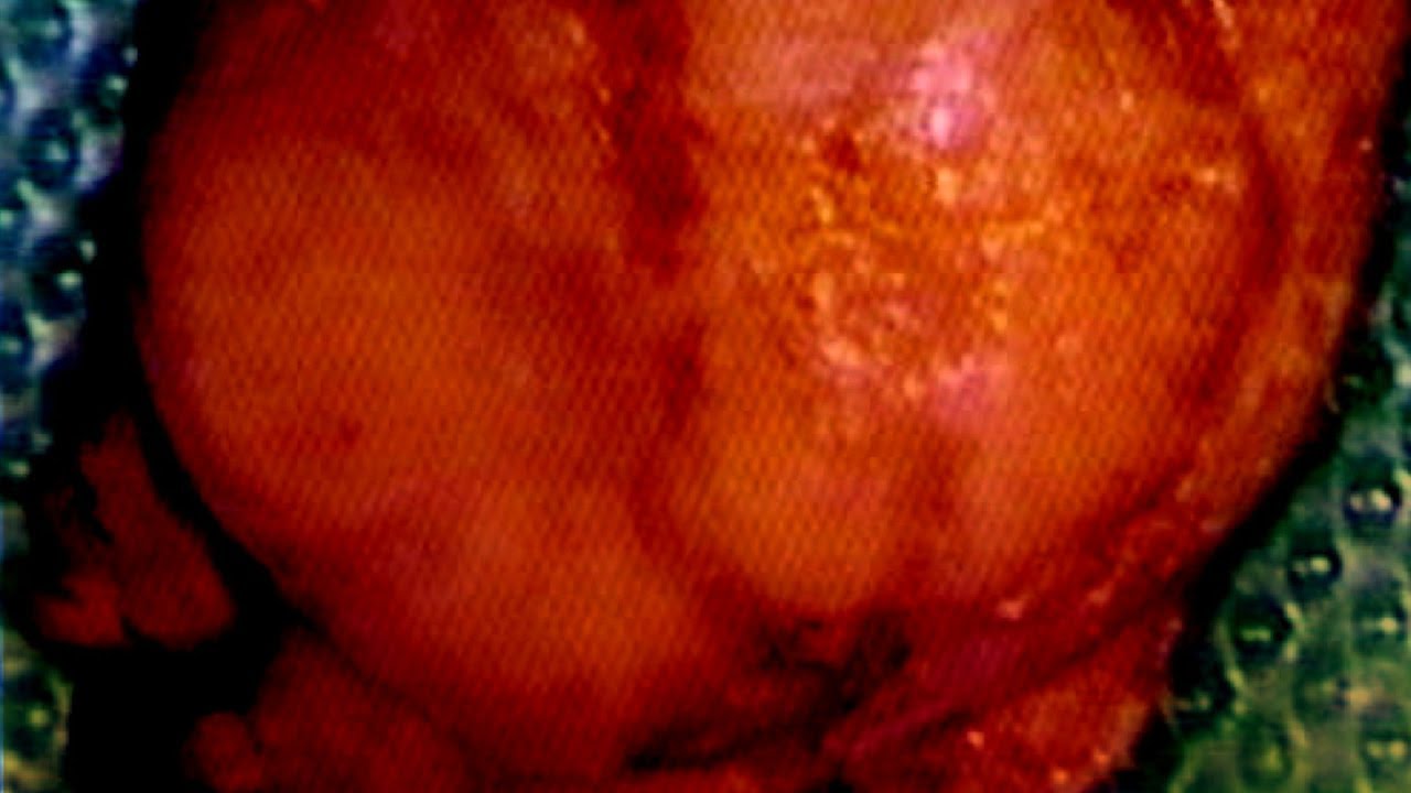 Carlos Gustavo Rivera Robledo-12