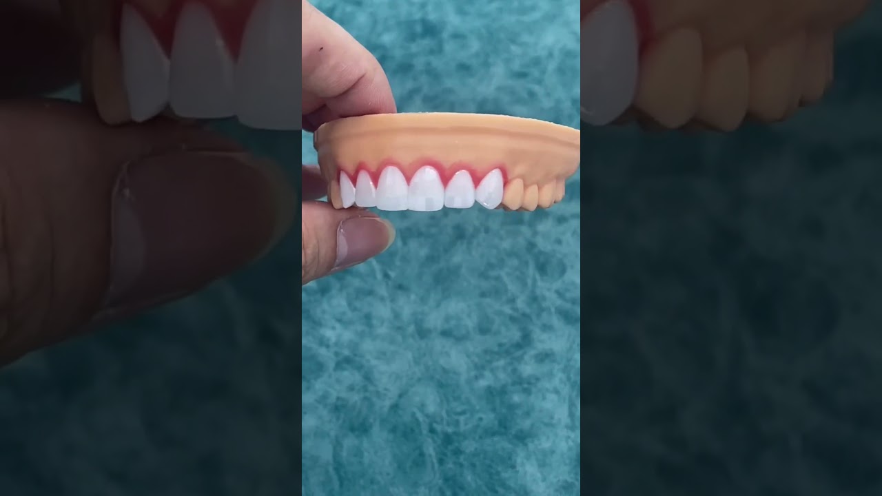 Nếu Đối Thủ Cũng Có Cùng Loại Răng Sứ, Bạn Cạnh Tranh Bằng Gì? 