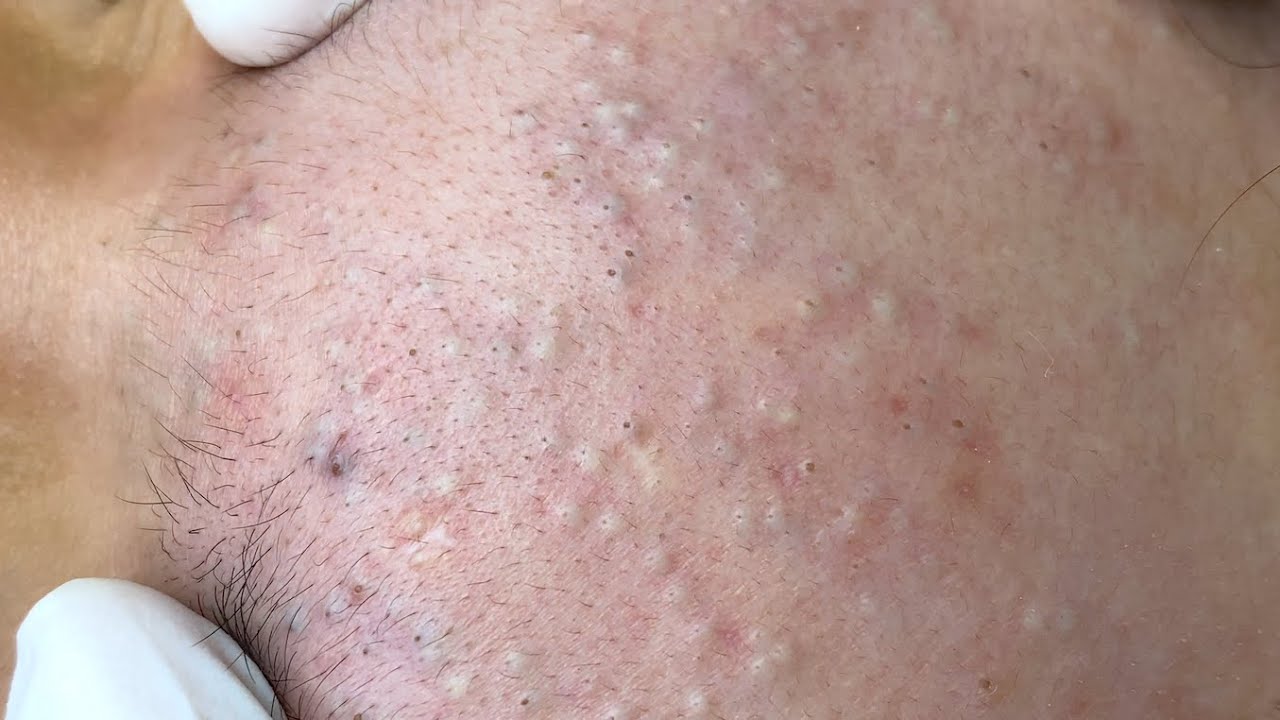 YouTube Thumbnail Downloader FULL HQ IMAGE