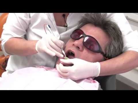 Parodontitisbehandlung mit dem Laser (Laserbehandlung bei Zahnfleischentzündung) Teil 1