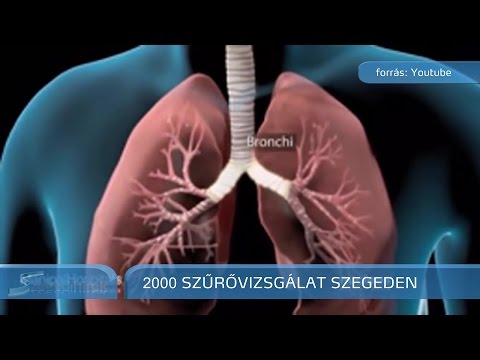 a genitális szemölcsök egy szemölcs