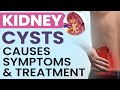 Kidney Cysts - Causes, Symptoms & Treatment