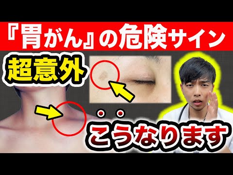 絶対に与えてはいけない、コガラにとって有毒な食べ物は何ですか？  庭園