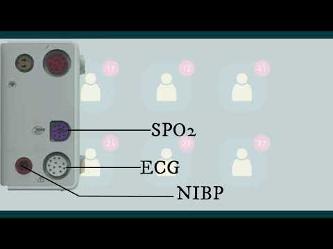 Patient Monitor Parameters Definitions Part 1 Biomedical Engineers TV