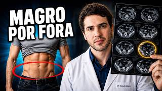 Gordura VISCERAL: o que é, como medir em casa e como perder de verdade!