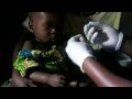 Rapid Diagnostic Test RDT For Malaria