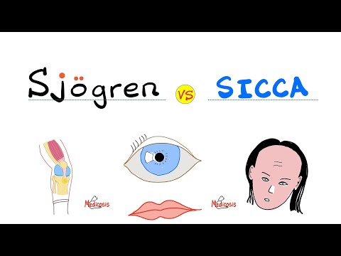 Sjögren Syndrome vs. Sicca Syndrome - Dry Eyes, Dry Mouth - Rheumatology Series