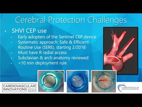 Cerebral protection challenges_Schwartz_Structural On Demand