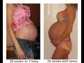 Comparing Twin Belly Pictures Vs A Singleton Pregnancy Unseen Photos Updated Postpartum Pics