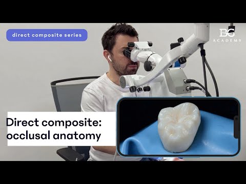 Direct Composite: Occlusal Anatomy