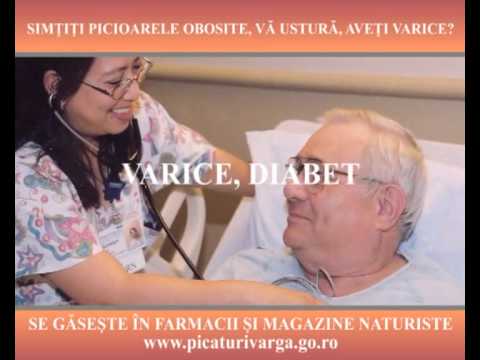 Trage burta în a 8-a săptămână de sarcină. Mama viitoare Uremine în vene varicoase