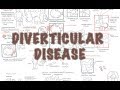 Diverticular Disease (diverticulitis) - Overview