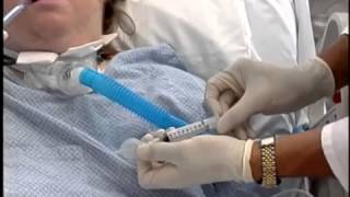 Passy-Muir® Valve - medical device used by tracheostomy and ventilator patients Passy-Muir® Valve - medical device used by tracheostomy and ventilator patients