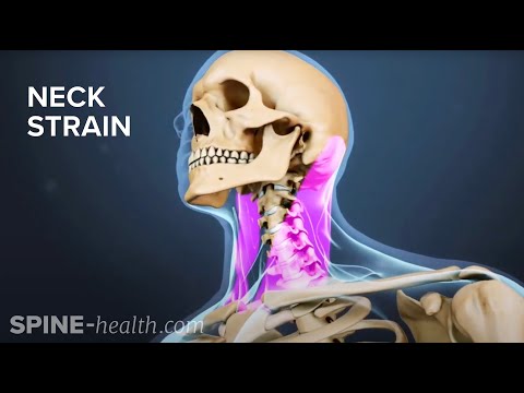 image-Is there tendons in your neck?