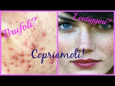 Brufoli e Lentiggini? nascondiamoli con il Make up!