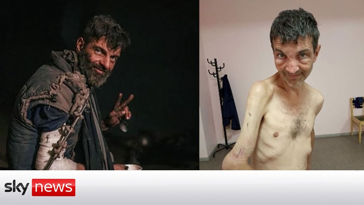 Ukrainian POW Reveals Torment at Hands of Russians
