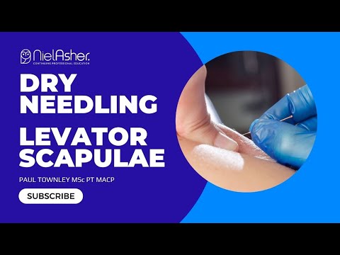 Levator Scapulae - Trigger Point Release