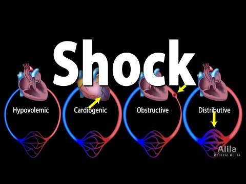 image-What causes circulatory shock?