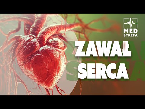 Krótko o zawale - co naprawdę dzieje się z Twoim sercem?