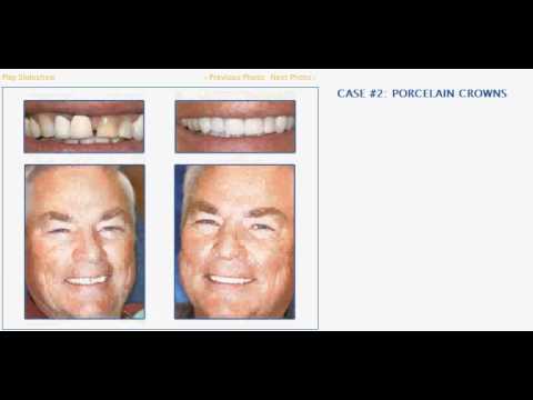 download lagu mp3 mp4 Cosmetic Dentist Huntsville Al, download lagu Cosmetic Dentist Huntsville Al gratis, unduh video klip Cosmetic Dentist Huntsville Al