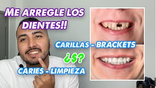 ¿Cuánto cuesta acomodarse los dientes Precios 2022 🦷💰