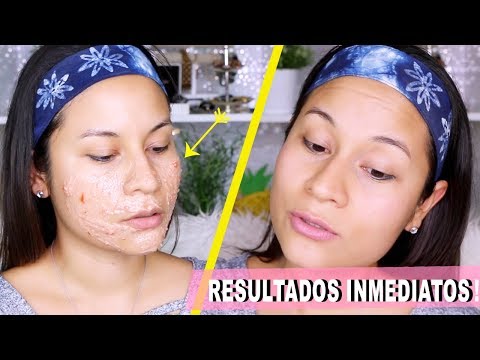 Mascarilla natural para piel grasa
