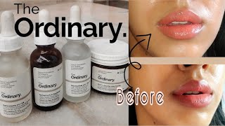 The Ordinary Skincare for Hyperpigmentation + Uneven Skintone (Best Products to fade pigmentation)