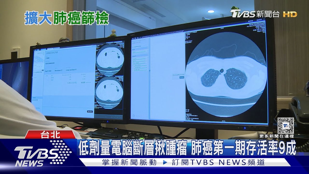不吸菸肺癌患者攀升「這些原因」致病!死亡率和發生人數最多的癌症