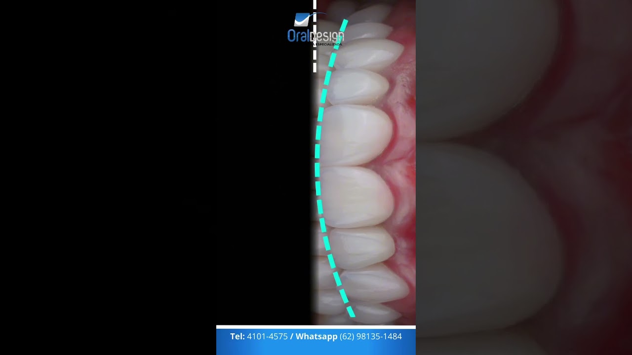 Danilo Monteiro Rezende Pereira-52
