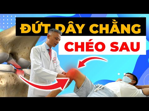 Đau Đầu Gối Không Chịu Nổi? Đứt Dây Chằng Chéo Sau - Giải Pháp Ngay Tại Đây