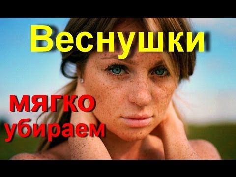 Видео танца на песню веснушки Пятна светлые края темные на коже