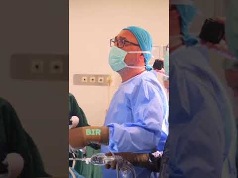 Açıklamalı özet tüp mide (Sleeve gastrektomi) ameliyatı