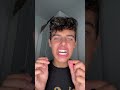 putting my retainers in after a MONTH!! #Shorts #Short Subscribe 👇