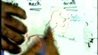 urinary bilharziasis 2  DR / SAMEH GHAZY