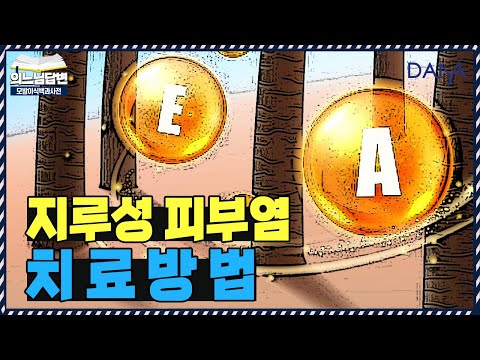 의느님답변????지루성 두피염,  증상 및 치료방법ㅣ지루성 두피염의 모든것②ㅣ다나성형외과(DANA)ㅣ모발이식ㅣ헤어라인교정ㅣ두피문신ㅣ탈모치료