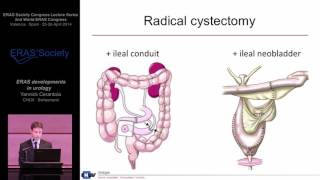 ERAS developments in Urology - Enhanced Recovery after Surgery (ERAS) video