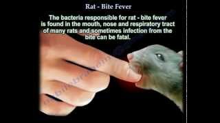 Rat Bite Fever - Everything You Need To Know - Dr. Nabil Ebraheim